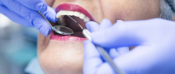Best Emergency Dental Surgery in Carthage, IL